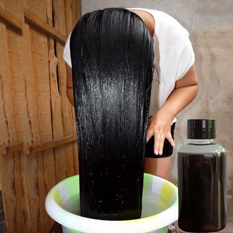 수제 순수 야채 헤어 에센스, 탈모 방지, 중국 허브  - Hair Care Korean Products 리뷰 및 가격