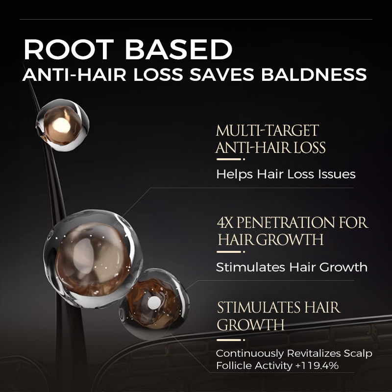 480ML 두피 케어 영양 샴푸 – 비듬과 유분감을 줄 - Hair Care Dandruff 리뷰 및 가격